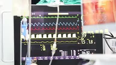 手术时的心电机医疗视频的预览图
